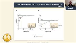 COPD  understanding the new GOLD guidelines with Dr Daniel Ray  January 04 2024 [upl. by Tehr]