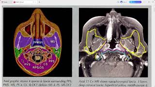 RADIOLOGY EXAM CASES [upl. by Anirdna737]