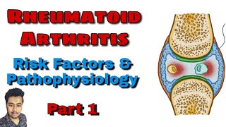 Rheumatoid Arthritis Types of Arthritis  Pathology  Treatment Nursing Lecture in Hindi Part 1 [upl. by Ailam760]