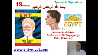 Pharynx 4 Mosaad AbdelAziz Tumours of the Pharynx amp Operations Tonsillectomy amp Adenoidectomy [upl. by Lipp559]