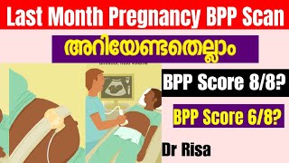 9 month Pregnancy ScanLast Month Pregnancy ScanWhat is BPP score [upl. by Burnie]