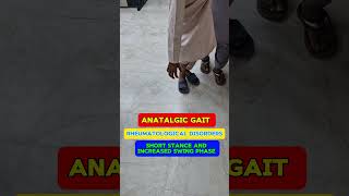 Antalgic gait video of patient  analysis example  description and pattern of Gait gait [upl. by Nostaw]