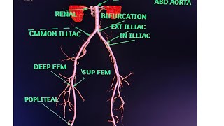 CT Lower Limb Angiography Anatomy CT scanPost processing avnishradiologypart1 [upl. by Laiceps]