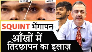 SQUINT  STRABISMUS TREATMENT  आँखों के भैंगापन  तिरछेपन का इलाज [upl. by Edyaj]