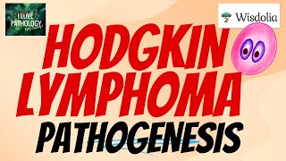 HODGKIN LYMPHOMA  PATHOGENESIS  ReedSternberg Cell [upl. by Della]