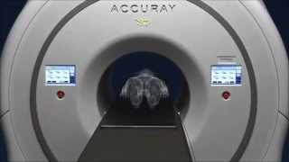 Accuray® TomoTherapy® H™ Series [upl. by Nannaihr]