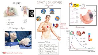 INFARCTUS DU MYOCARDE IDM  PHYSIOPATHOLOGIE ET DIAGNOSTIC [upl. by Lumbard]