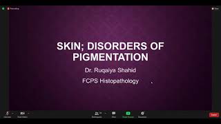 Disorders of Pigmentation  Pathology [upl. by Amata253]