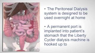 Fresenius Liberty Cycler Peritoneal Dialysis Recall [upl. by Rhoda]