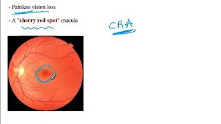 Video 219 Common Refractive Errors amp Retinal Pathologies Clinical Presentations amp Diagnosis [upl. by Anamor]