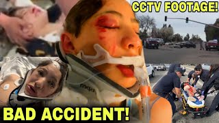 FOOTAGE of Nidal Wonder SCOOTER CRASH ACCIDENT 😱😳 TERRIBLE CAR ACCIDENT EXPLAINED [upl. by Akinahs]