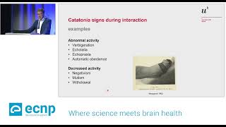 Catatonia aetiology presentation assessment and treatment 2392024 [upl. by Amlus]