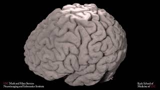 Locus Coeruleus pathways to Transentorhinal Cortex [upl. by Nahtaj]