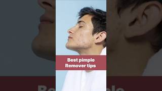 Best pimple Remover tips3fitness [upl. by Virendra]