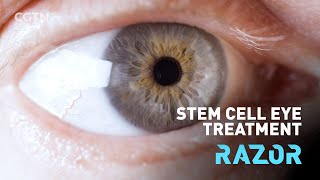 Stem cell eye treatment RAZOR [upl. by Rol745]