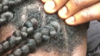 ASMRALL ZOOMED SATISFYING BRAIDS SCRATCHING 😴 [upl. by Nodnal]