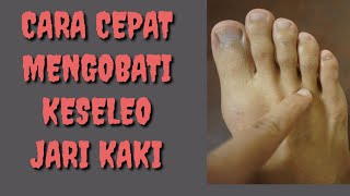 CARA CEPAT MENGOBATI KESELEO JARI KAKI MUDAH SIMPLE DAN MANJUR [upl. by Dhu]