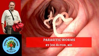 Parasitic Worm Infections Part 1 [upl. by Aicelf]