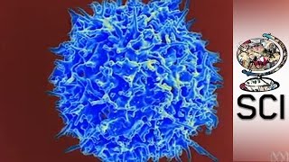 The First Man To Be Cured Of HIV [upl. by Llib]