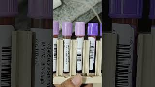 HbA1C Test Hematology Lab resultD 10 [upl. by Samuelson]