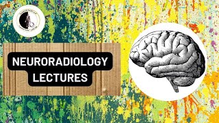 Trigeminal neuralgia  Dr Ahmed ElAgamy [upl. by Nylia]