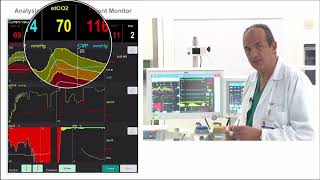 What are the hemodynamics effect of acute hypercapnia and acute hypoxia [upl. by Jun33]