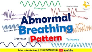 ABNORMAL BREATHING PATTERN  Apnea  Bradypnea  Tachypnea  Ataxic  Sighing  CheyneStokes [upl. by Gut895]