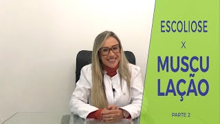 Escoliose x Musculação  Parte 2  Dra Josiane Barros [upl. by Ellenad]