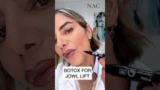 jowls jowllift jowltreatment botox botoxtraining drbitafarrell [upl. by Ydde964]