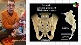 آلام أسفل الظهر والعصعص  Lower back and coccyx pain [upl. by Daas]