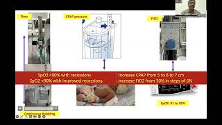 Non invasive ventilation in neonate by Dr Srinivas Murki [upl. by Staffan]