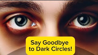 Beauty health  Say Goodbye to Dark Circles  Mrotterl [upl. by Combes]