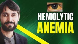 Hemolytic Anemia  Causes  Symptoms  Diagnosis and Treatment  MLT Hub with kamran [upl. by Lyrac]