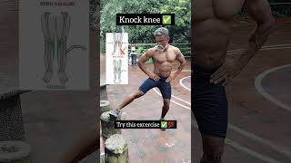 knock knee problem excercise ✅💯 Try this excercise ✅💯 knock knee bbtofficial gym shorts [upl. by Asiulana]