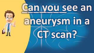 Can you see an aneurysm in a CT scan   Good Health and More [upl. by Edobalo]