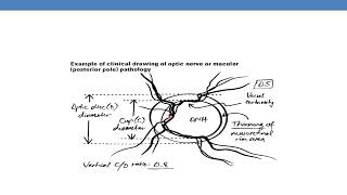 CPT CODING GUIDELINES FOR MEDICINE PART 7 Ophthalmology [upl. by Jeunesse]