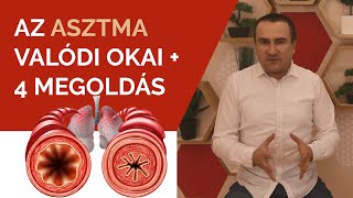 Az asztma valódi okai  4 megoldás [upl. by Lord861]