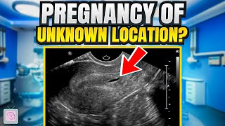 Pregnancy of unknown location  What does it mean for you [upl. by Nedyah]