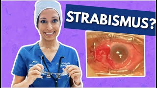 What To Expect With Strabismus Surgery  Eye Surgeon Explains [upl. by Uriia]