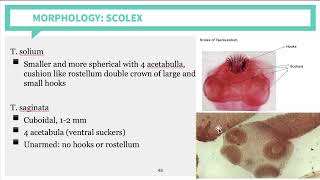 Parasitology Cestodes Part 2 [upl. by Ylen]