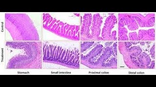 Differences in histology of the Large intestine and Small intestine [upl. by Conway]