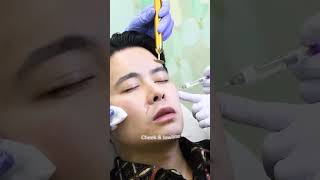 ATIERE  FACE CONTOURING  Cellscience Klinik [upl. by Ahsened]