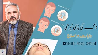 Naak ki Hadi Tedi Hona in Urdu I نا ک کی ہڈی ٹیرھی I Deviated Nasal Septum Symptoms Causes Treatment [upl. by Kingsly]