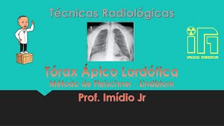 Radiografia do Tórax AP  Ápico Lordótico  método de Fleischner [upl. by Edahc]