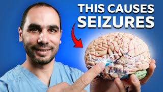 Neurologist Explains How Epilepsy ACTUALLY Works [upl. by Akenat782]