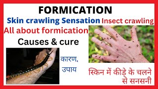 FormicationInsect crawling sensation on skinCause amp Cureस्किन पर कीड़े का रेंगना कारण और ईलाज [upl. by Newell407]