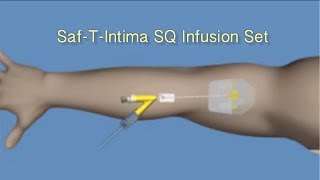 How to Insert SafTIntima™ SQ Infusion Set [upl. by Ayekel]