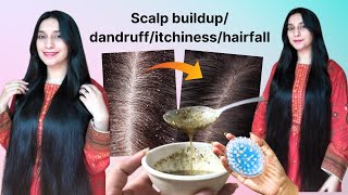 scalp build up removalscalp build up removal home remediesdandruff hairfall hairfall scalp [upl. by Birmingham]