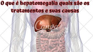 O que é hepatomegalia quais são os tratamentos e suas causas [upl. by Anaibaf]