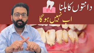 LOOSE TEETH Treatment Home Remedies [upl. by Llehcar]